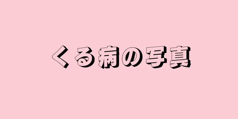 くる病の写真